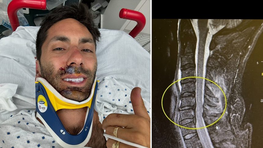 Thrilling Twist: Nev Schulman Faces Life-Altering Bike Accident