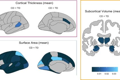 Unraveling the Mind: How Conduct Disorder Transforms Brain Structures in Youth