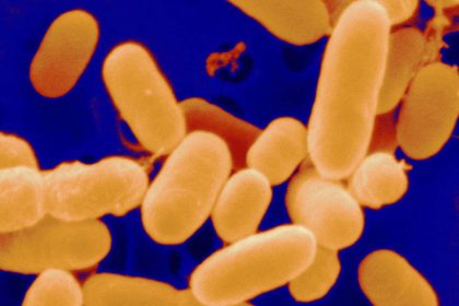 Revolutionary Discovery: Gut Bacteria from Stool Proven to Heal Chronic Wounds!