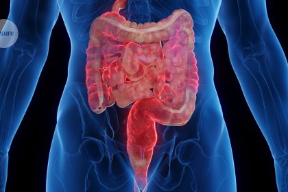 Unlocking the Secrets of Inflammatory Bowel Disease: A Promising Path to Revolutionary Therapies