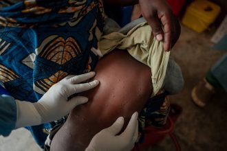 UNICEF Teams Up with Africa CDC, Gavi, and WHO to Launch Urgent Tender for Mpox Vaccines in Crisis-Affected Countries!