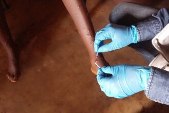 WHO Greenlights Groundbreaking Mpox Diagnostic Test for Emergency Use, Paving the Way for Global Access!